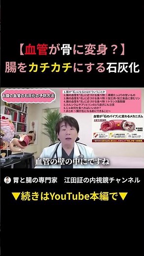 【血管の石灰化の恐怖】動脈が骨のようにカチカチに硬くなる原因とメカニズム