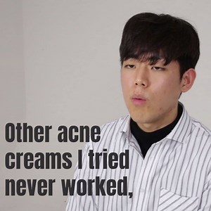 162K views · 621 reactions | "It's the best skin I've ever had" One customer's 6-week review. Check out the result and see why it's so popular! Where to buy >> https://goo.gl/JdmLPE | EarlyPicker - Early Picker | Facebook