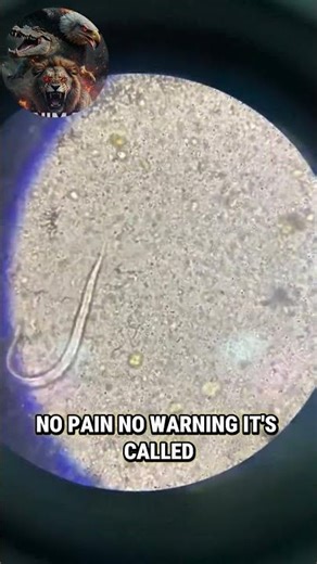 This Animal Can Enter Through Your Skin…😳