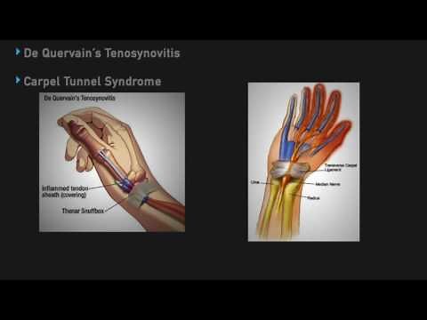 How to do Intra articular injections