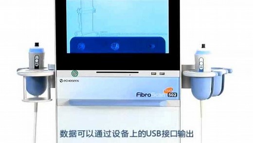 FibroScan操作视频