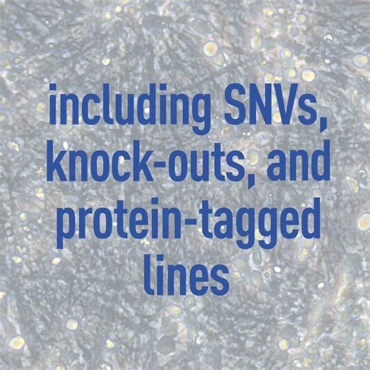 Human Stem Cells from The Jackson Laboratory