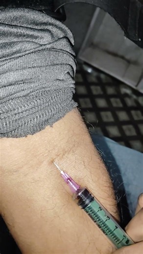 iv injection fast technique🌟