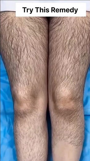 Remove Unwanted Body Hair Easily Without Wax| Permanently Remove Full Body Hair At Home #hairremoval