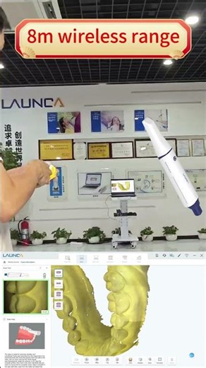 Launca wireless scanner---8m wireless range