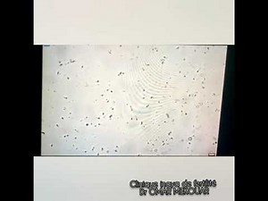 L'insémination artificielle intra-utérine avec sperme du conjoint à la clinique inaya de fertilité