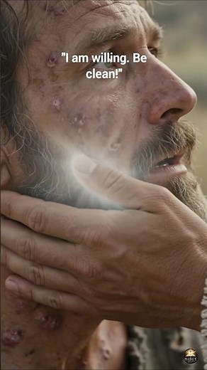 Jesus Touched the Leper... And He Was Instantly Healed! |