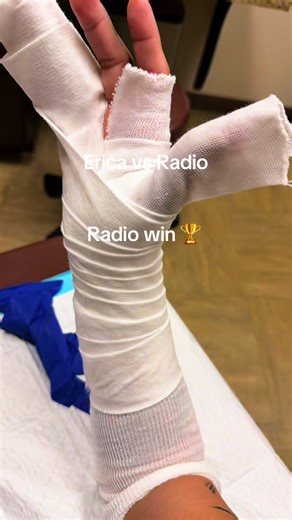 #CapCut #brokenbone #CapCut #wontdothatagain