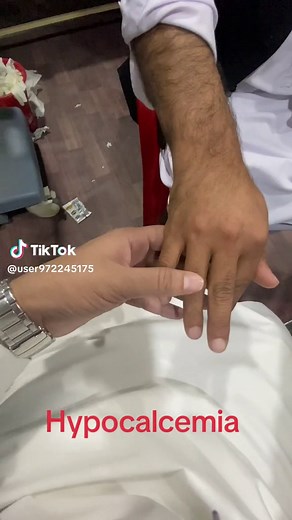 Understanding Hypocalcemia: Symptoms and Effects