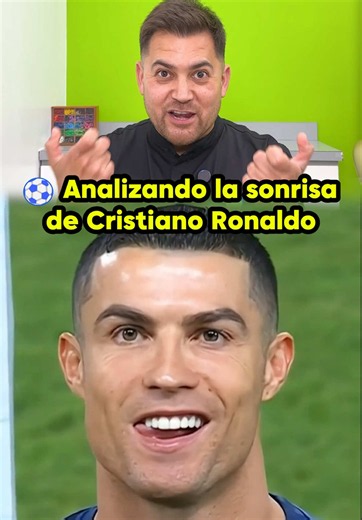 Analizando la sonrisa de Cristiano Ronaldo 🦷✨ . . . #dentista #cr7 #ortodoncia #brackets #braces
