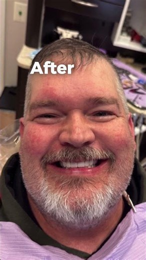 Dr. Singh Restored His Smile.
