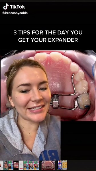 Tips for day of expander 🦷😌🤍 #expander #braces #expanders #bracesoff #bracestips #bracesguide