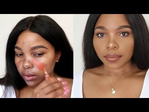 HOW TO COVER HYPERPIGMENTATION AND DARK SPOTS ON BROWN SKIN