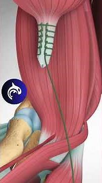 See what a Distal Biceps Rupture & Surgical Repair look like in a 4K 3D animation.