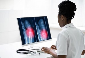 When AI becomes a healthcare tool to detect fractures