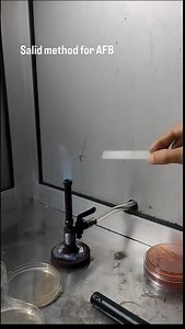 The Ziehl–Neelsen stain, also known as the acid-fast stain, is a routine bacteriological staining technique used in cytopathology and microbiology to identify acid-fast bacteria under microscopy, particularly members of the Mycobacterium genus. This staining method was initially introduced by Paul Ehrlich (1854–1915) and subsequently modified by the German bacteriologists Franz Ziehl (1859–1926) and Friedrich Neelsen (1854–1898) during the late 19th century. These acid-fast bacteria possess a wa