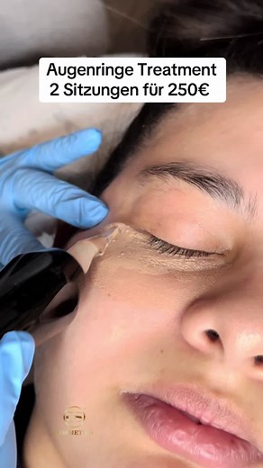 Dunkle Augenringe effektiv entfernen bei CS Cosmetics