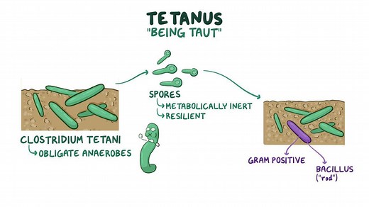 Video: Clostridium tetani (Tetanus) - Video Explanation! | Osmosis | Osmosis