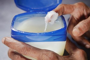 The Hidden Power of Petroleum Jelly: The Affordable Product That Saves Your Skin!