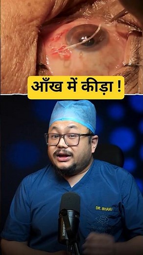 Worm in the Eye? What Is Ocular Ascaris? | Educational Eye Video