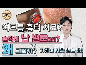 모든 시술 다 받아본 의사의 여드름 흉터 치료 비용과 가성비 순서! 왜 효과가 없었을까? 레이저/고주파, 서브시전, 도트필링 정리!