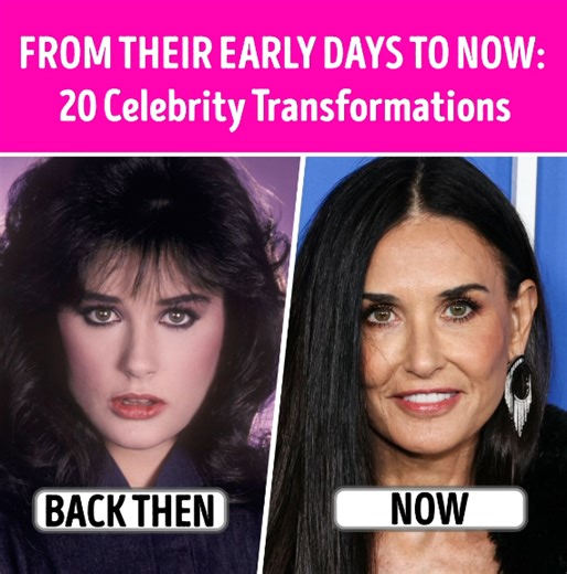 From Their Early Days to Now: 20 Celebrity Transformations | CelebRatings