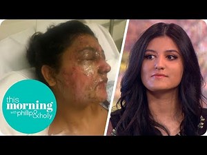 The Aspiring Model Scarred for Life in an Unprovoked Acid Attack | This Morning
