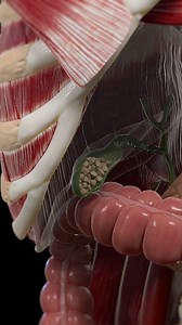 1.4M views · 1.7K reactions | " Understanding Gallbladder Stones ...