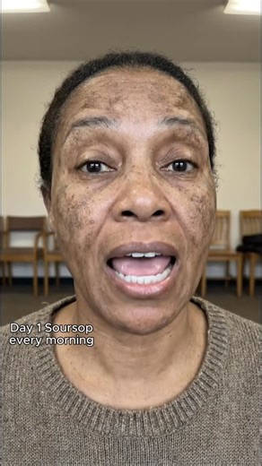 Vanessa Clark on Instagram: "Comment your age if you’re from the US 🇺🇸 Follow my Instagram @vanessa.healthtips for daily updates 😇 Get your Soursop below 👇 https://amzn.to/3JqcOiT #soursop #guthealth #usahealth #womenshealth #us"