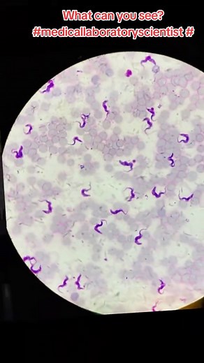 Medical Laboratory Science: What Can You See?