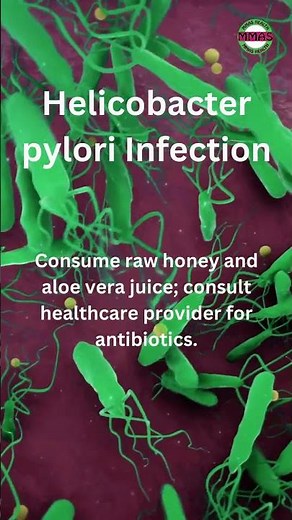 Helicobacter Pylori Infection Of the Stomach