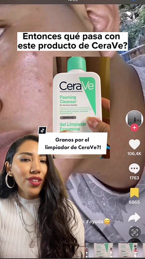 Efecto Purga: Diferencia entre Purga y Reacción en la Piel