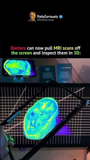 This Technology Makes MRI Scans Look Like Holograms