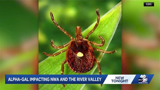 Local Alpha-gal expert speaks to 40/29 News