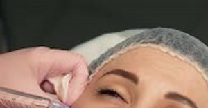 Treatment Injection Procedure Anti Aging Injections for Female Face Skin Using Syringe in