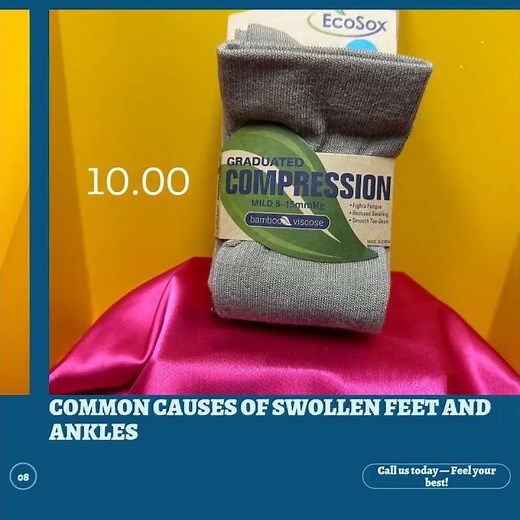 Common Causes of Swollen Feet and Ankles