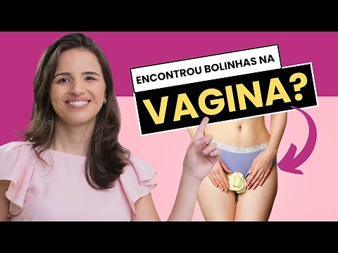 CINCO CAUSAS DE BOLINHA NA VAGINA QUE VOCÊ DEVE CONHECER E SABER COMO TRATAR!