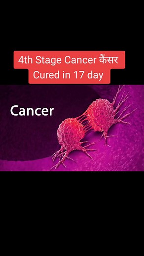 4th Stage Cancer Cured in 17 Days with Yoga and Naturopathic Remedies