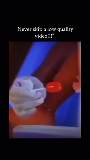 Viral nations (VN) | 🤣🤣🤣 This video opens in what appears to be a surgical setting: two medical staff in blue scrubs, caps, and masks stand over a patient... | Instagram