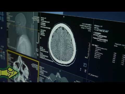 ΤΣΙΠ ΣΤΟΝ ΕΓΚΕΦΑΛΟ; Η ΝΕΑ ΤΕΧΝΟΛΟΓΙΑ ΠΟΥ ΑΝΟΙΓΕΙ ΤΕΡΑΣΤΙΑ ΕΡΩΤΗΜΑΤΑ