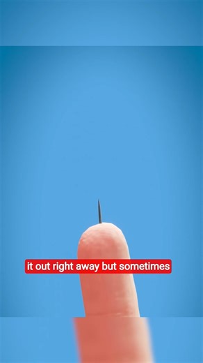 Your Body Can Push Out a Splinter — Here’s How 🤯