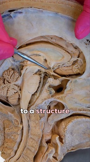 What Happens During an Adrenaline Rush? Your Body's Emergency Response! ⚡🧠 Let's break down the lightning-fast chain reaction happening inside your body! The Trigger 🚨 Your brain recognizes: A threat Extremely stressful situation Intense sporting event The Chain Reaction 🔗 1️⃣ Amygdala recognizes the threat 2️⃣ Relays info to the hypothalamus (central brain core) 3️⃣ Hypothalamus activates sympathetic nervous system (fight or flight!) The Immediate Effects ⚡ The sympathetic nervous system has