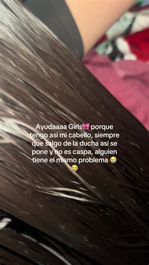 Consejos para tratar el cabello graso y la caspa
