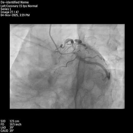 Visualizing the Heart’s Arteries | Coronary Cineangiography