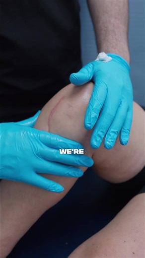 Knee Surgery Recovery: Physical Therapy Guide