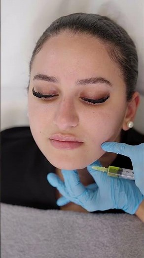 Sculpt Your Way to a Defined Jawline: Lemon Bottle Fat Dissolving Injection at Este Medical