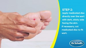 Dr. Scholl's Clear Away Plantar Wart Remover Extra-Thick Bandages for Feet, 24 Treatments - Clinically Proven Effective Wart Removal and Cushioning Pain Relief, Comfortable Multi-Day Coverage Patches