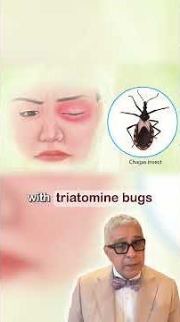 Chagas Disease Explained: A Silent Infection You Should Know