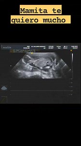 47 reactions · 5 comments | Escucha esto si eres mamá. Así es cómo suena un corazón ❤️ sano. #eco4denmonterrey #ginecologa #embarazada #SaludYBienestar #eco4d | DepoDental Plus | Facebook