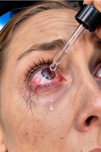 Jimerito Honey Eye Drops – Refreshing Moisturizing Relief for Dry Eyes